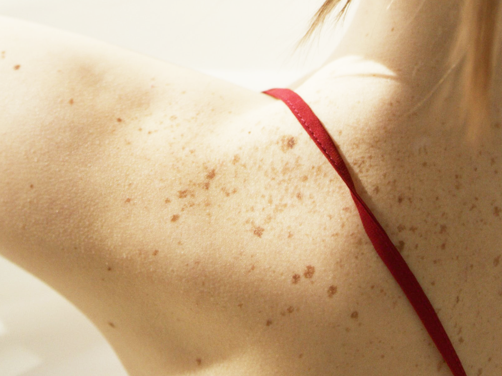 apgamu salinimas vasara