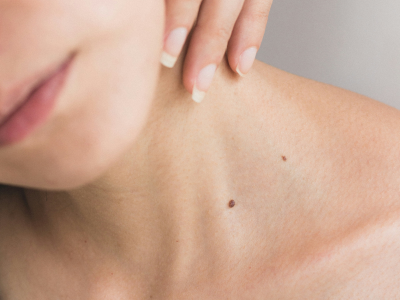 estetines odos proceduros